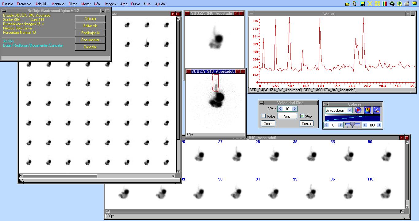 Course Image Procedimientos en Medicina Nuclear I 2025
