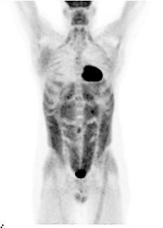 Course Image Curso de Metodología y Aplicación de Radioisótopos para Profesionales Médicos 2025