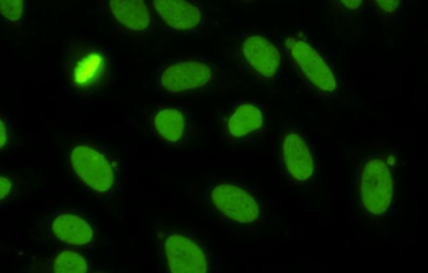 Course Image BC 1 - Área Autoinmunidad (2025)